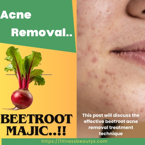 Acne removal by beetroot